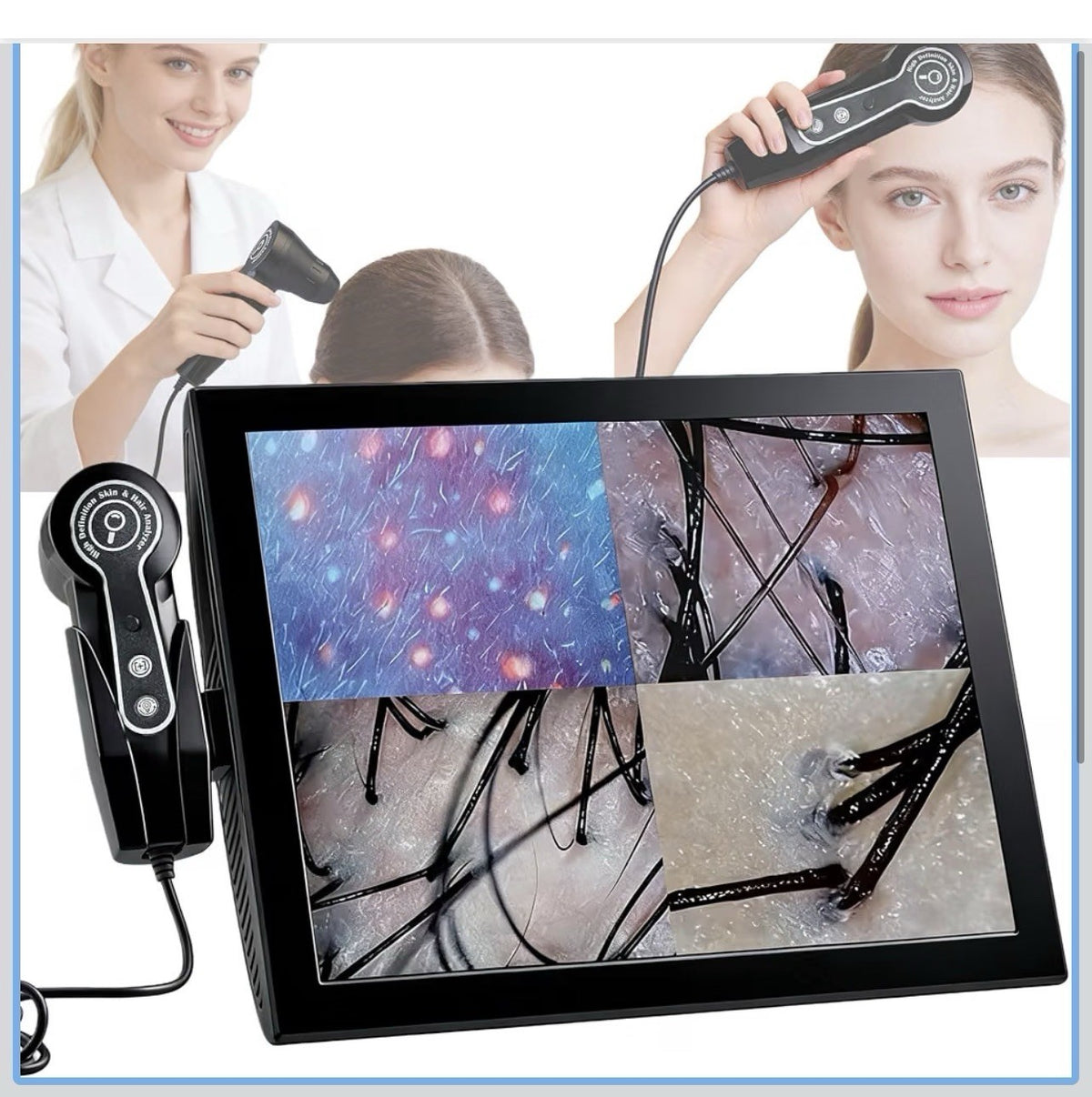 Professional 15-Inch Scalp-Camera for Salons & Spas – High-0